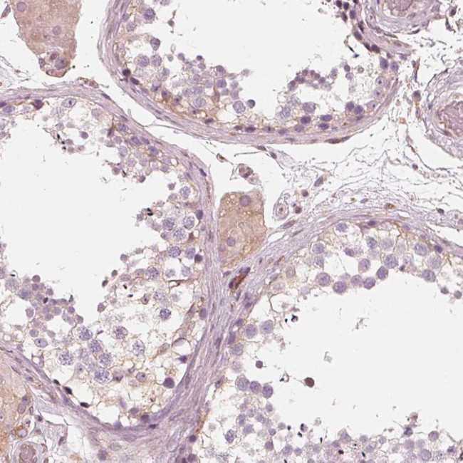 IKBIP Antibody in Immunohistochemistry (Paraffin) (IHC (P))