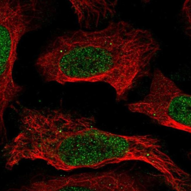 CREB5 Antibody in Immunocytochemistry (ICC/IF)