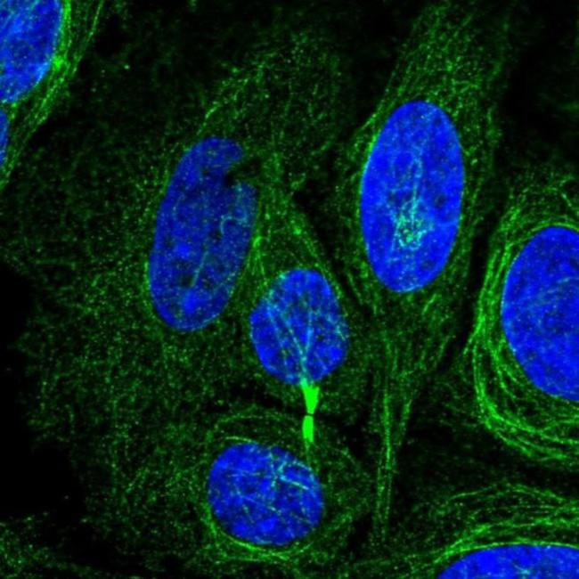 KIAA1211L Antibody in Immunocytochemistry (ICC/IF)