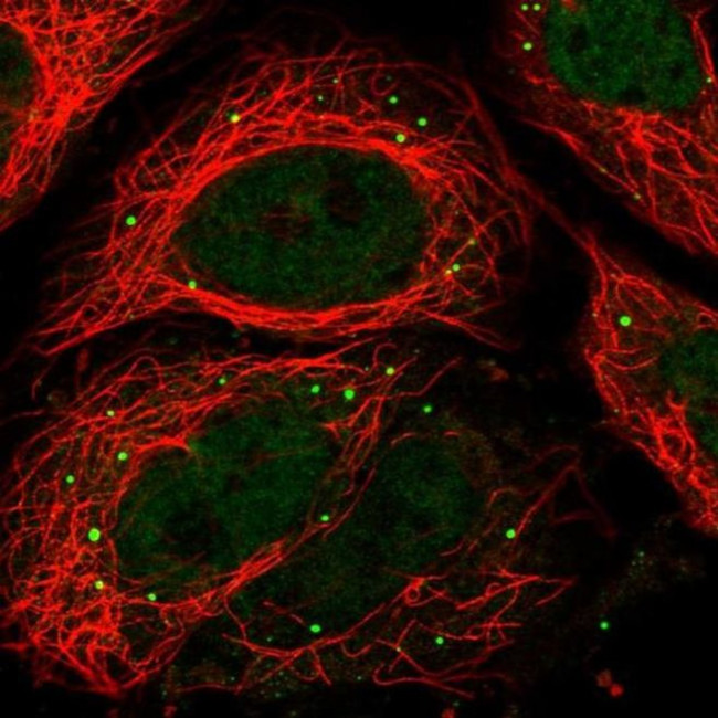 RPRD2 Antibody in Immunocytochemistry (ICC/IF)