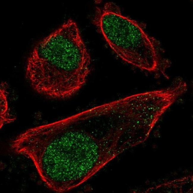 PRPF31 Antibody in Immunocytochemistry (ICC/IF)