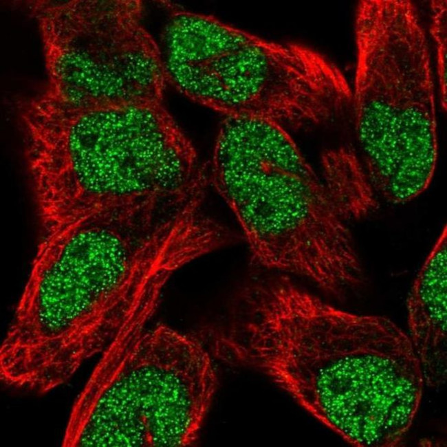 TNRC6C Antibody in Immunocytochemistry (ICC/IF)