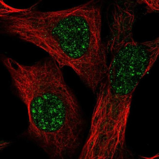 TMEM179B Antibody in Immunocytochemistry (ICC/IF)