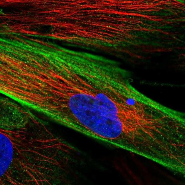 FAM167B Antibody in Immunocytochemistry (ICC/IF)