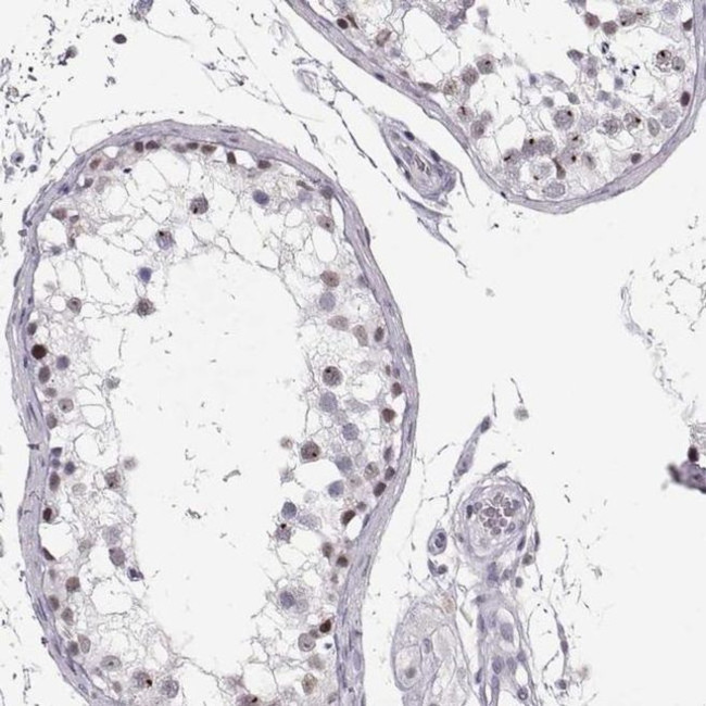 TEPP Antibody in Immunohistochemistry (IHC)