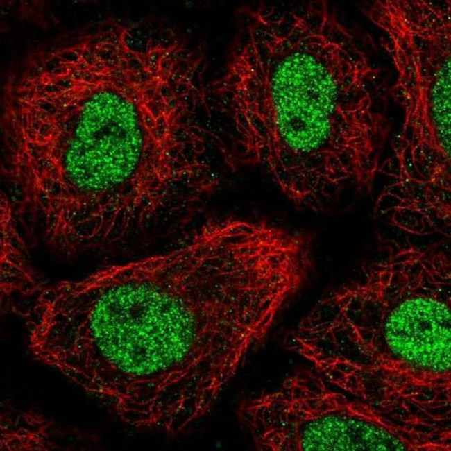TGIF Antibody in Immunocytochemistry (ICC/IF)