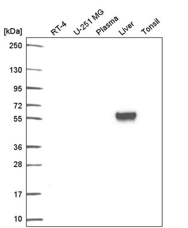 Lamin B Receptor Antibody in Western Blot (WB)
