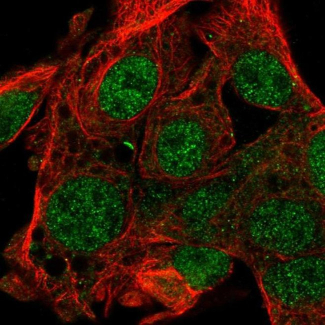 FAM222B Antibody in Immunocytochemistry (ICC/IF)