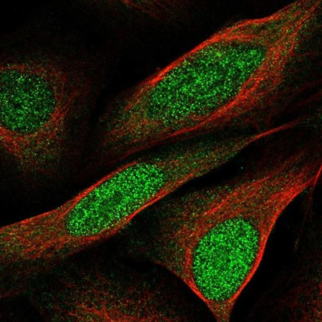 CCDC3 Antibody in Immunocytochemistry (ICC/IF)