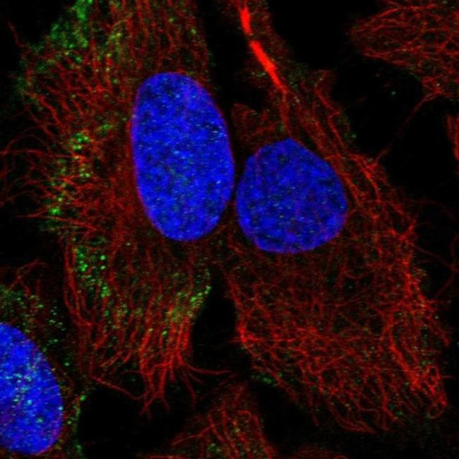 PARVB Antibody in Immunocytochemistry (ICC/IF)