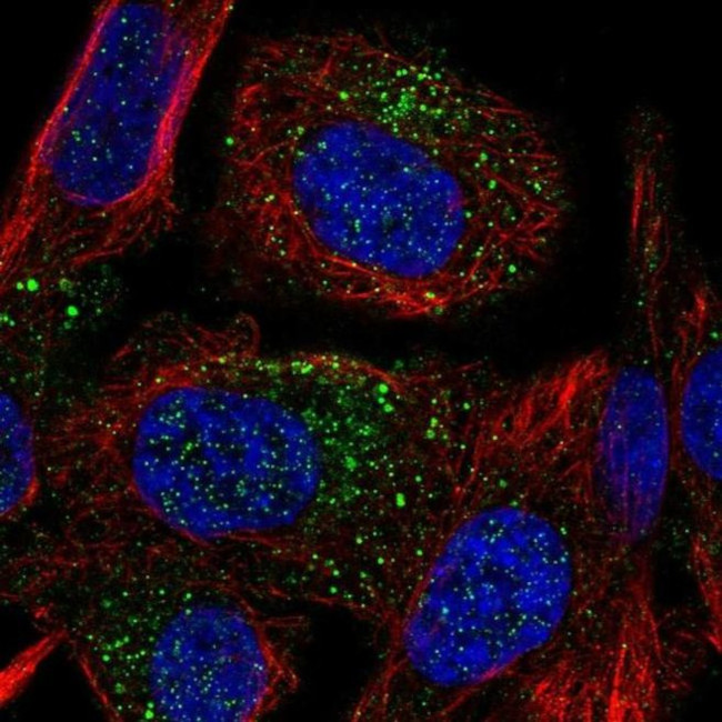 TMEM8B Antibody in Immunocytochemistry (ICC/IF)