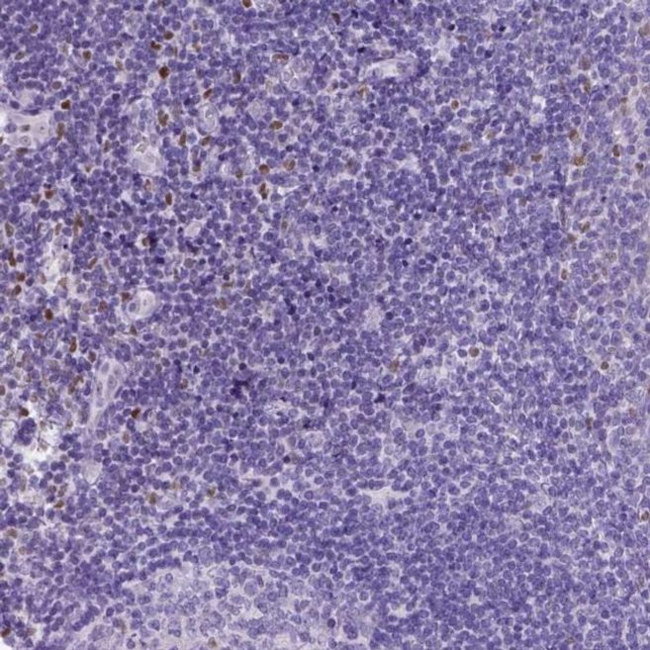 CRB1 Antibody in Immunohistochemistry (IHC)