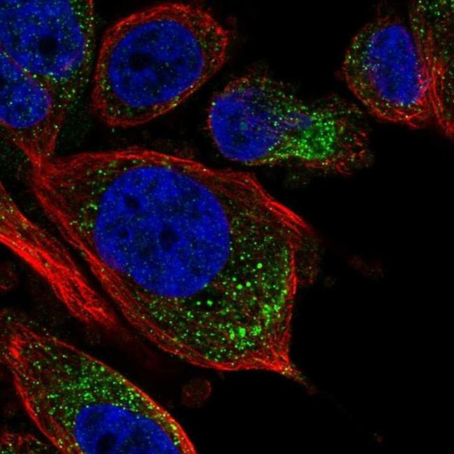 TPRG1L Antibody in Immunocytochemistry (ICC/IF)
