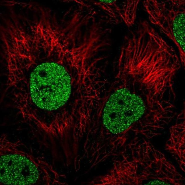 BNC1 Antibody in Immunocytochemistry (ICC/IF)