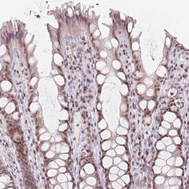MOZ Antibody in Immunohistochemistry (IHC)