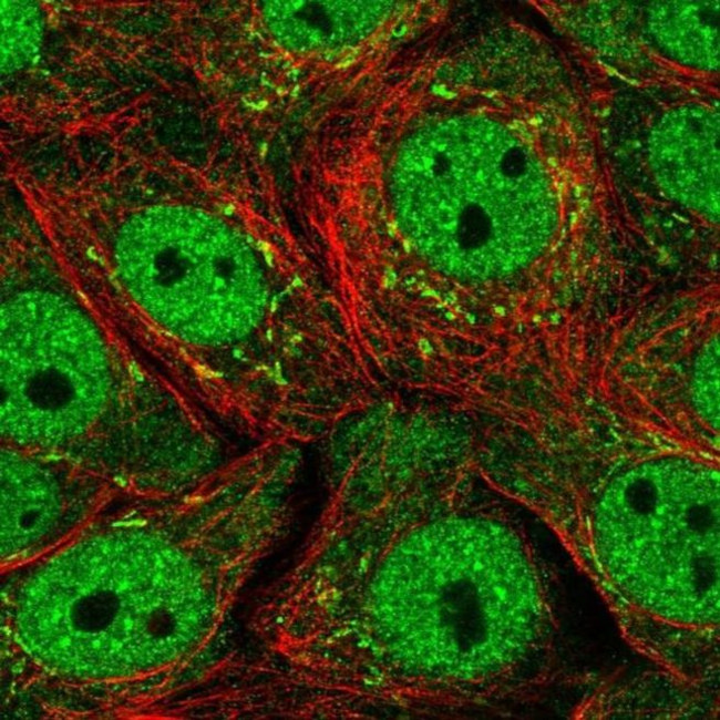 SERTAD1 Antibody in Immunocytochemistry (ICC/IF)