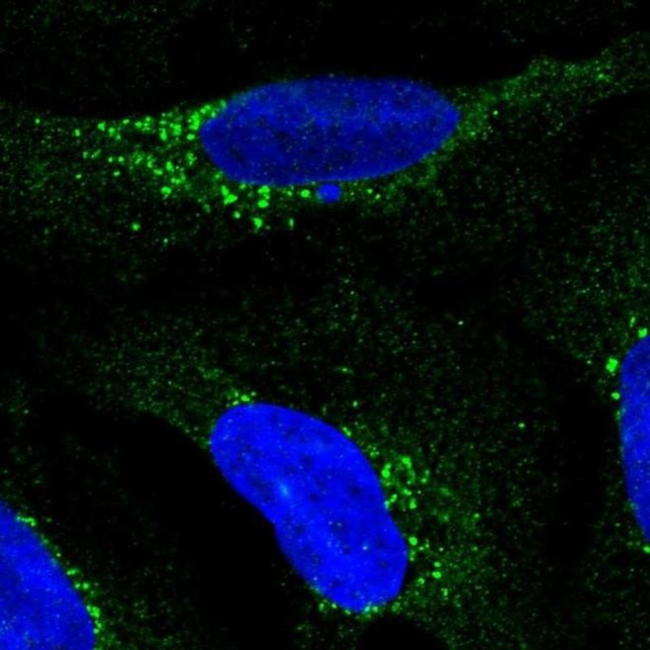 RDH5 Antibody in Immunocytochemistry (ICC/IF)