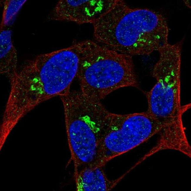 FAM228B Antibody in Immunocytochemistry (ICC/IF)