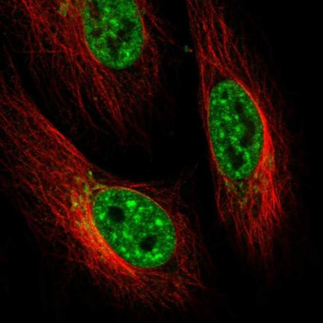 ENTHD2 Antibody in Immunocytochemistry (ICC/IF)