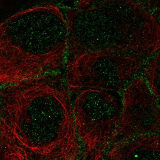 OSR2 Antibody in Immunocytochemistry (ICC/IF)