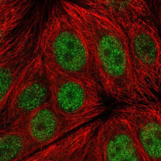 C14orf1 Antibody in Immunocytochemistry (ICC/IF)