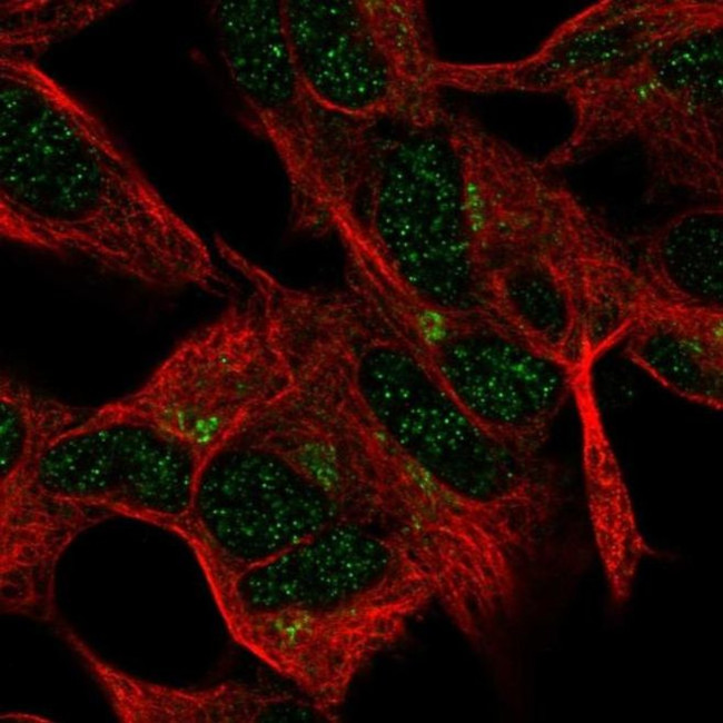 FEM1A Antibody in Immunocytochemistry (ICC/IF)