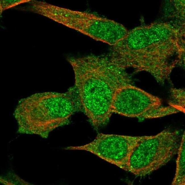 PMM2 Antibody in Immunocytochemistry (ICC/IF)