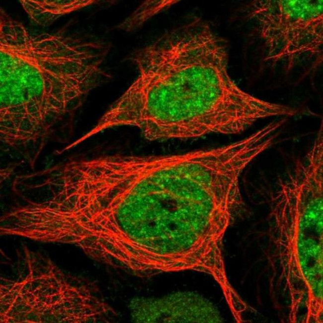 BAZ2A Antibody in Immunocytochemistry (ICC/IF)