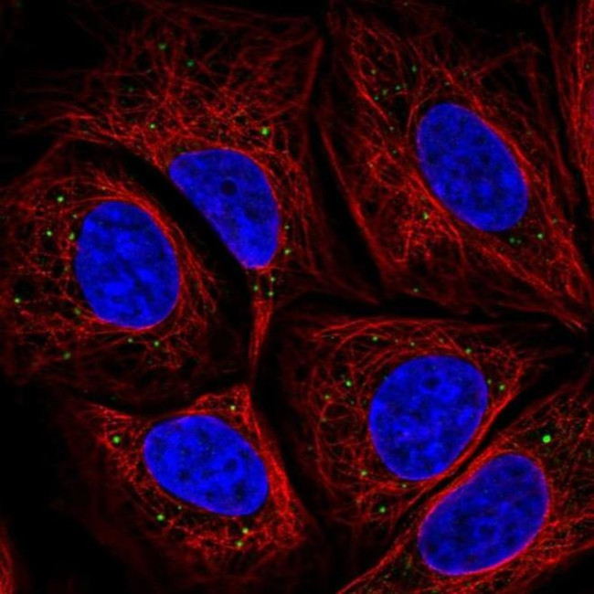 HTRA3 Antibody in Immunocytochemistry (ICC/IF)