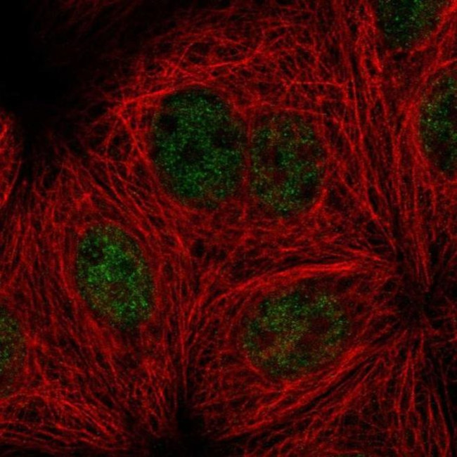 SMEK1 Antibody in Immunocytochemistry (ICC/IF)