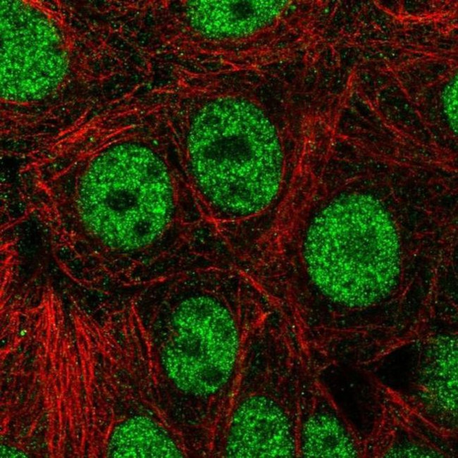 ZNF335 Antibody in Immunocytochemistry (ICC/IF)