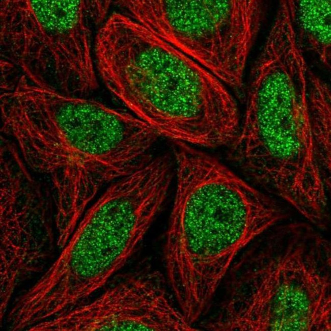 MED14 Antibody in Immunocytochemistry (ICC/IF)