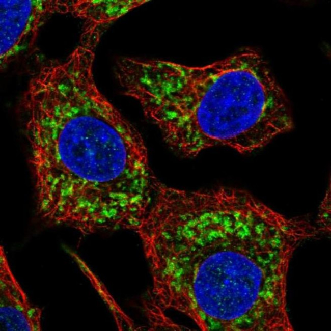 HKDC1 Antibody in Immunocytochemistry (ICC/IF)