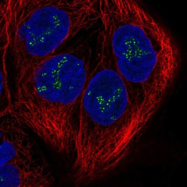 C20orf12 Antibody in Immunocytochemistry (ICC/IF)
