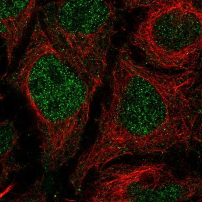 TMEM8A Antibody in Immunocytochemistry (ICC/IF)