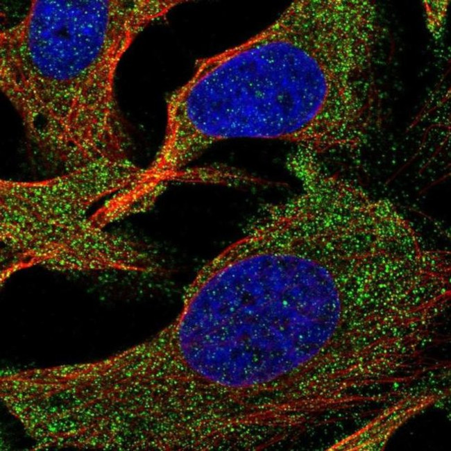 SLC35G2 Antibody in Immunocytochemistry (ICC/IF)