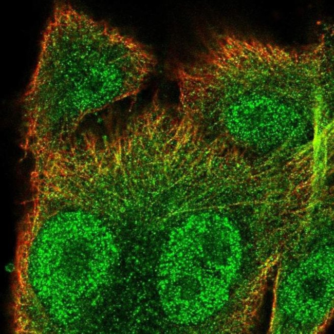 SNX10 Antibody in Immunocytochemistry (ICC/IF)