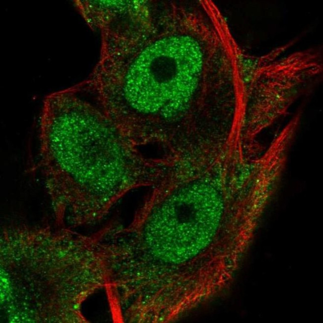 RNF13 Antibody in Immunocytochemistry (ICC/IF)