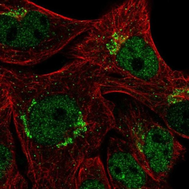 CYP2U1 Antibody in Immunocytochemistry (ICC/IF)