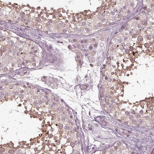 VWA5B1 Antibody in Immunohistochemistry (IHC)