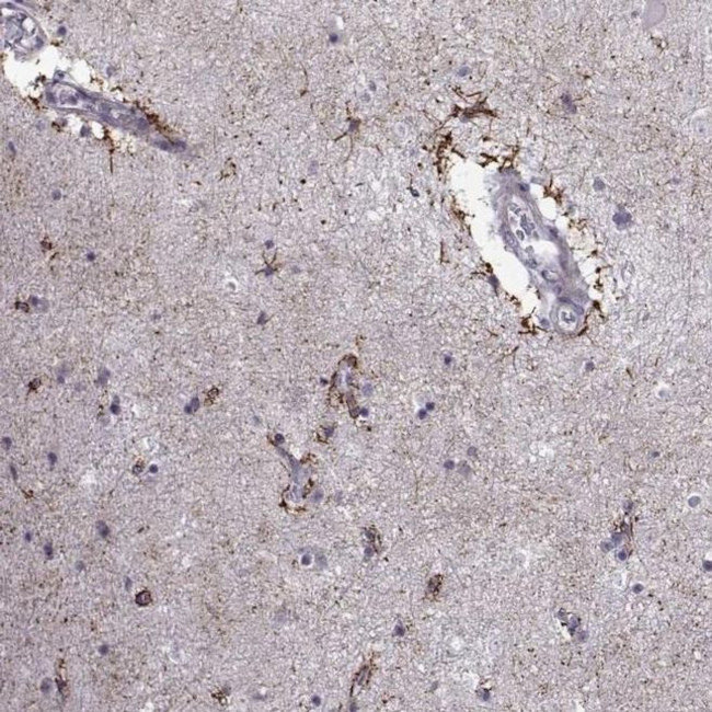 NPW Antibody in Immunohistochemistry (IHC)