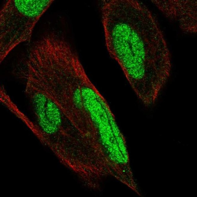 PKNOX1 Antibody in Immunocytochemistry (ICC/IF)
