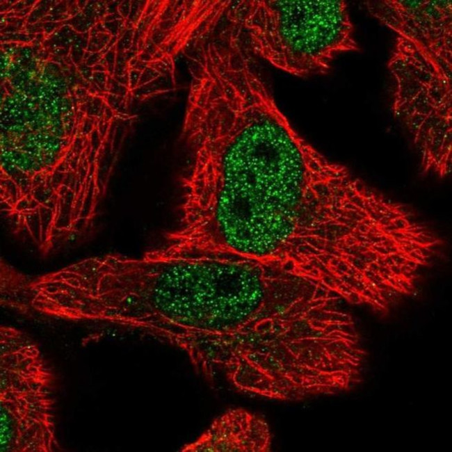 OSTC Antibody in Immunocytochemistry (ICC/IF)