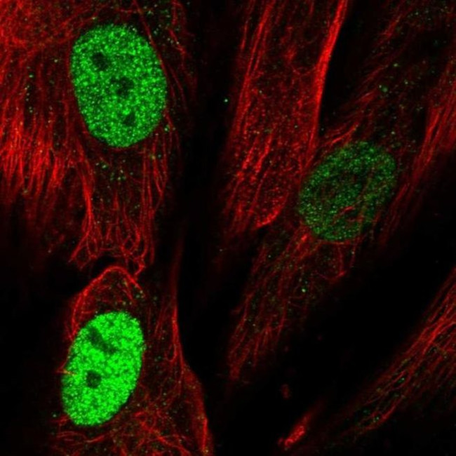 TLE4 Antibody in Immunocytochemistry (ICC/IF)