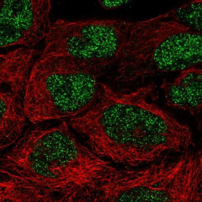 NAALAD2 Antibody in Immunocytochemistry (ICC/IF)
