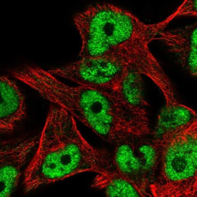 ZNF559 Antibody in Immunocytochemistry (ICC/IF)