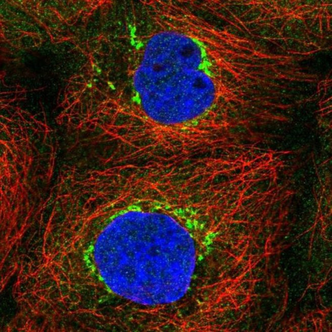 TVP23C Antibody in Immunocytochemistry (ICC/IF)