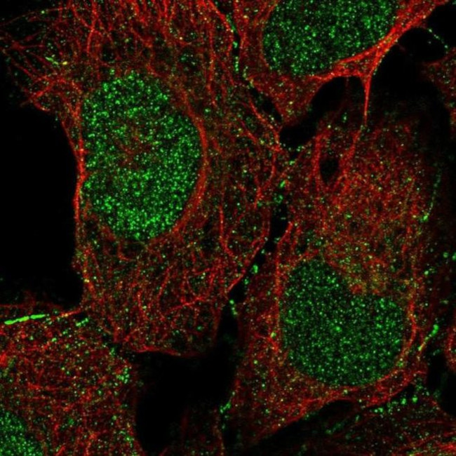 DOC2A Antibody in Immunocytochemistry (ICC/IF)