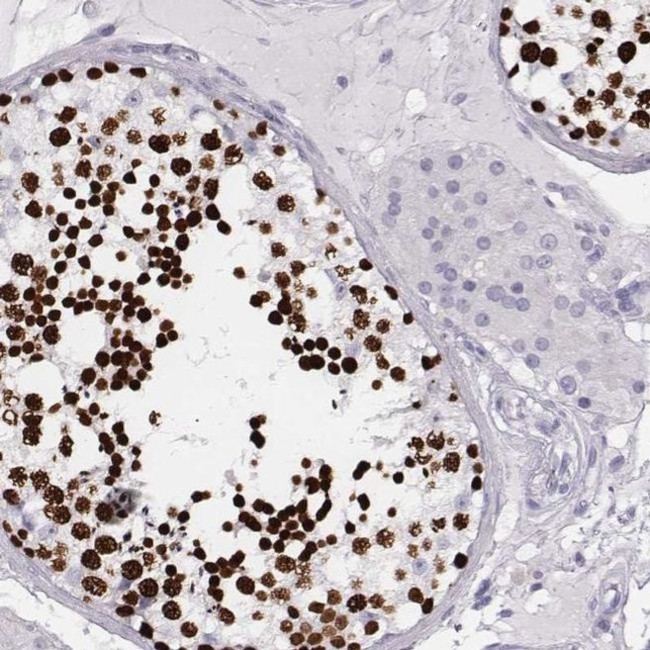Histone H1T Antibody in Immunohistochemistry (IHC)