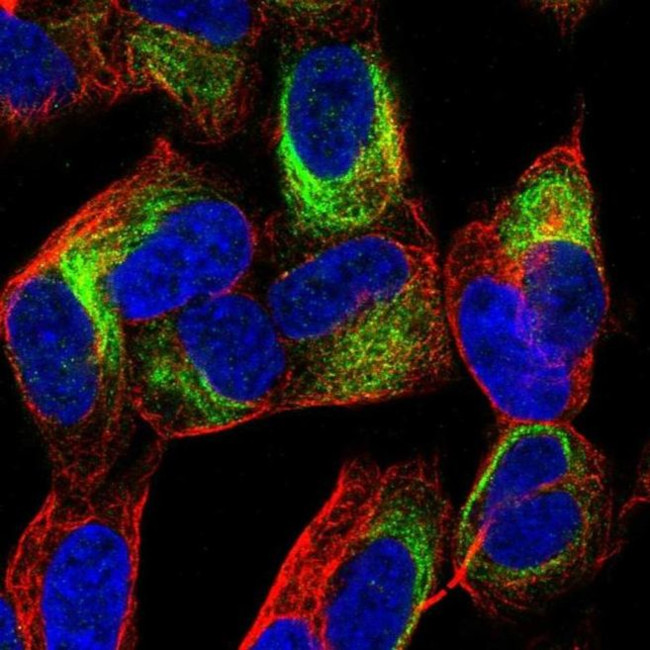 TBC1D16 Antibody in Immunocytochemistry (ICC/IF)